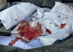 Sheets covered in blood