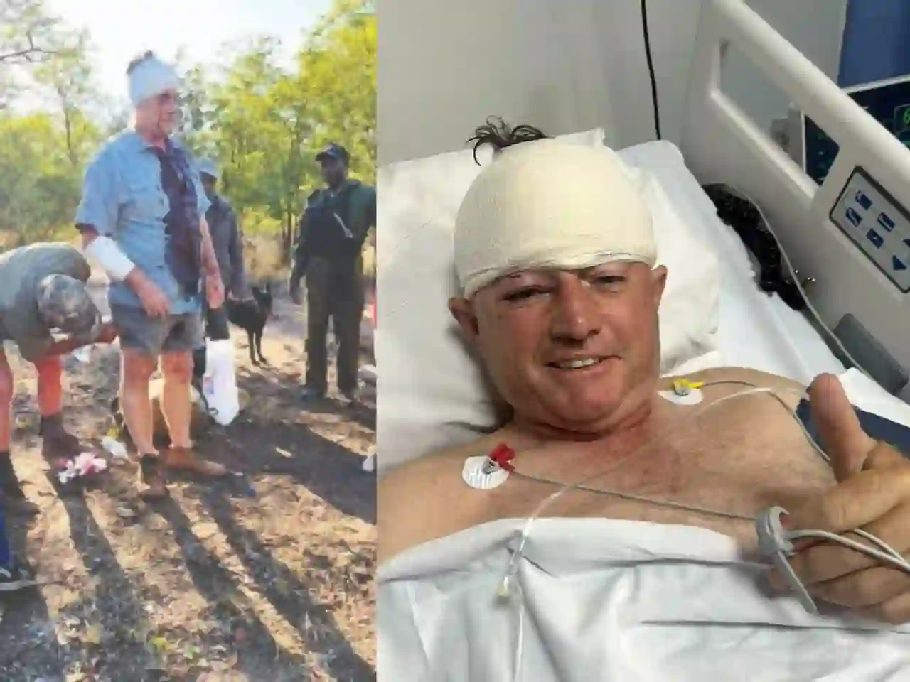 Photographs of Guy Whittall after being attacked by the leopard